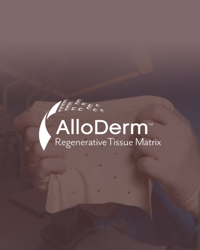 AlloDerm is an acellular dermal matrix