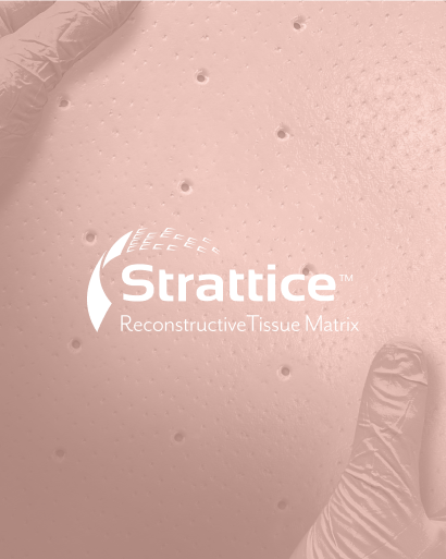 Strattice is soft tissue patch